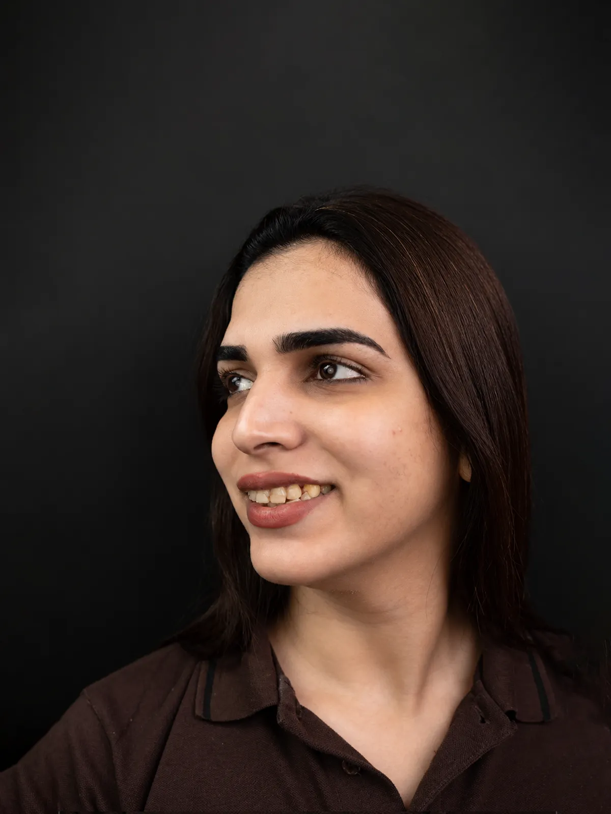 Before: Smile makeover