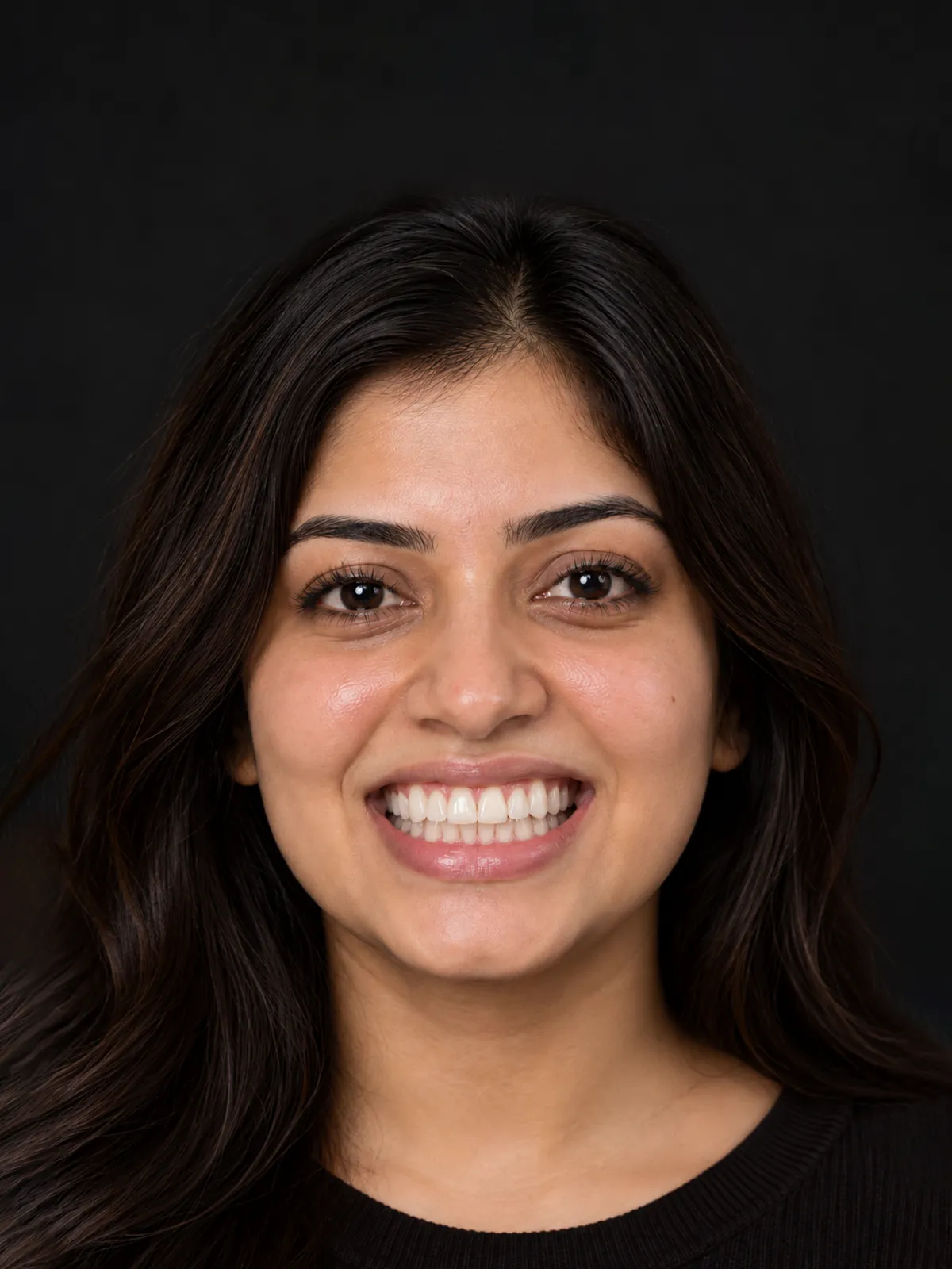 Digital simulation of a possible result: Smile makeover